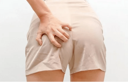 Coceira anal