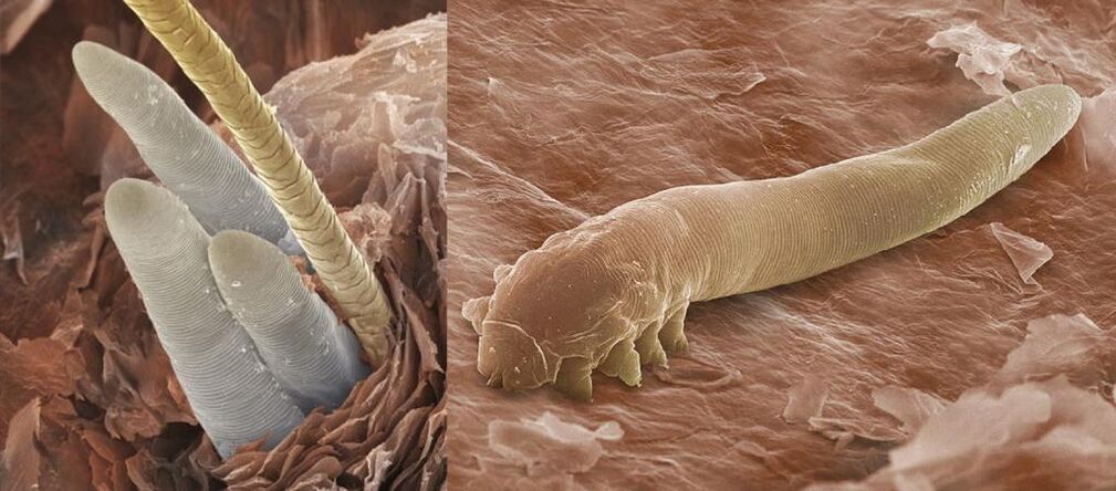 Ectoparsitas