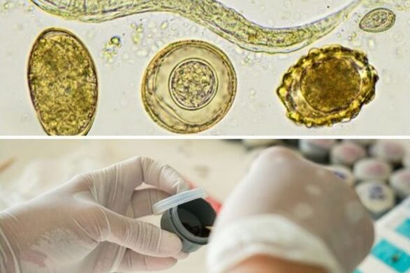 diagnóstico da presença de parasitas no corpo