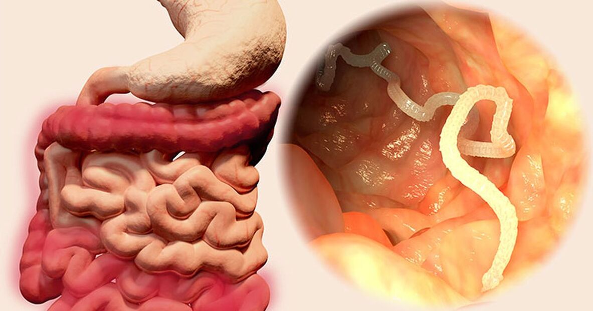parasitas no intestino humano