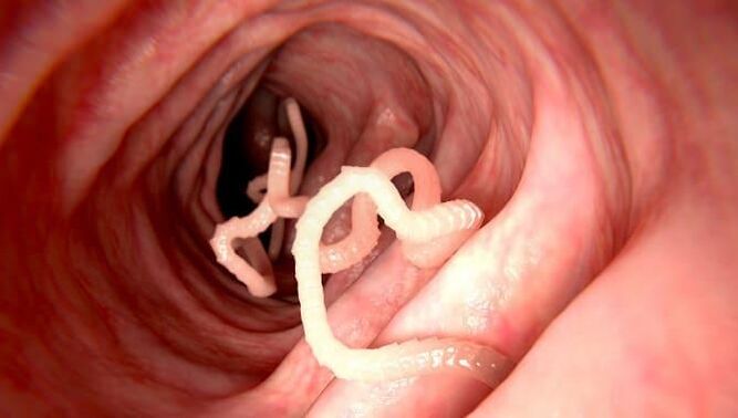 Vermes que vivem no intestino humano