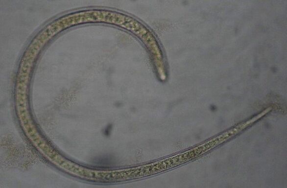 Trichinella é um verme parasita redondo protostômico