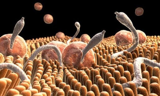 parasitas